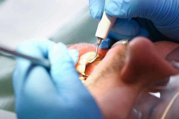 Best Pediatric Emergency Dentist in Tamalpais Homestead Valley, CA