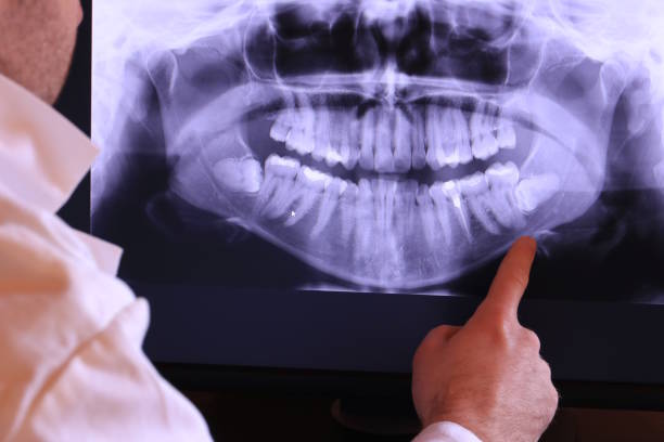 Best Broken or Cracked Tooth Emergency Dentist in Tamalpais Homestead Valley, CA