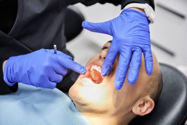 Best Emergency Dentist for Knocked-Out Tooth in Tamalpais Homestead Valley, CA